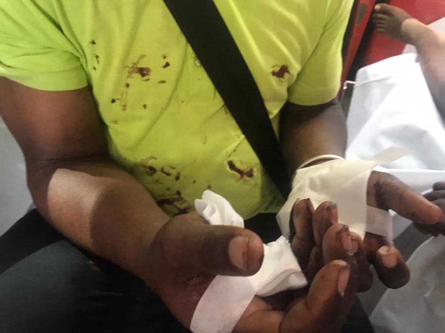 cinq-eleves-un-chauffeur-bus-agresses-arme-blanche-majicavo-koropa