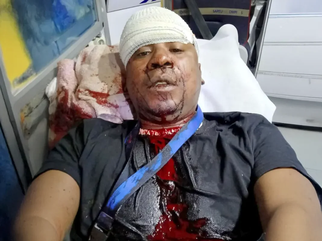Un homme agressé à coups de machette devant chez lui à Cavani
