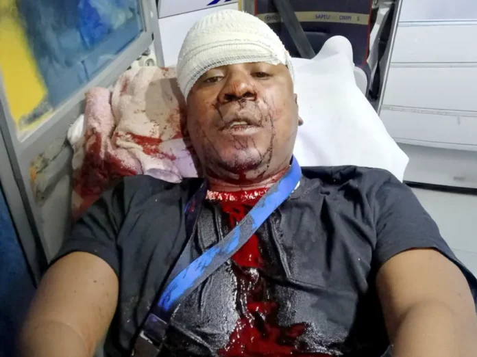 Un homme agressé à coups de machette devant chez lui à Cavani